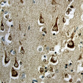 Sortilin Antibody in Immunohistochemistry (Paraffin) (IHC (P))