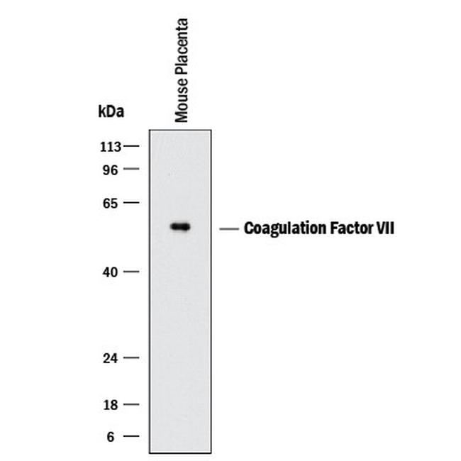Factor VII Antibody in Western Blot (WB)