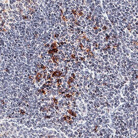 OX40 Antibody in Immunohistochemistry (Paraffin) (IHC (P))