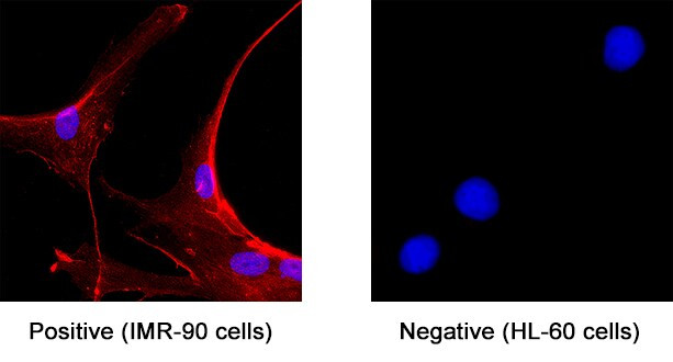 Syndecan 3 Antibody in Immunocytochemistry (ICC/IF)