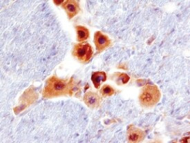 RGMB Antibody in Immunohistochemistry (Frozen) (IHC (F))