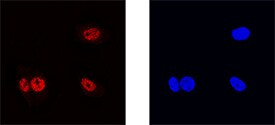 ZNF24 Antibody in Immunocytochemistry (ICC/IF)