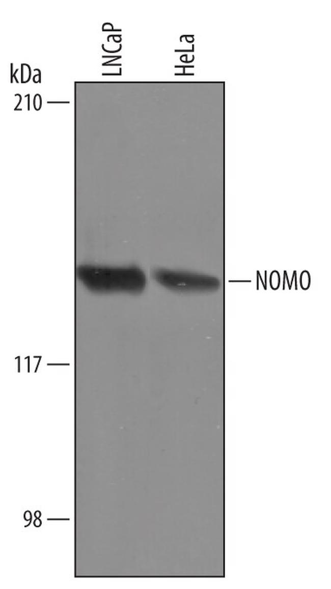 NOMO1 Antibody in Western Blot (WB)