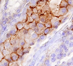 CDHR5 Antibody in Immunohistochemistry (Paraffin) (IHC (P))