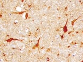 Tenascin R Antibody in Immunohistochemistry (Paraffin) (IHC (P))