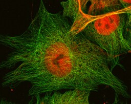 ZNF206 Antibody in Immunocytochemistry (ICC/IF)