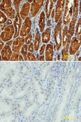 Renin Antibody in Immunohistochemistry (Paraffin) (IHC (P))