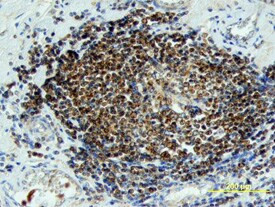 WNT6 Antibody in Immunohistochemistry (Paraffin) (IHC (P))