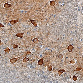 SorCS2 Antibody in Immunohistochemistry (Paraffin) (IHC (P))
