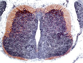 CDCP1 Antibody in Immunohistochemistry (Frozen) (IHC (F))