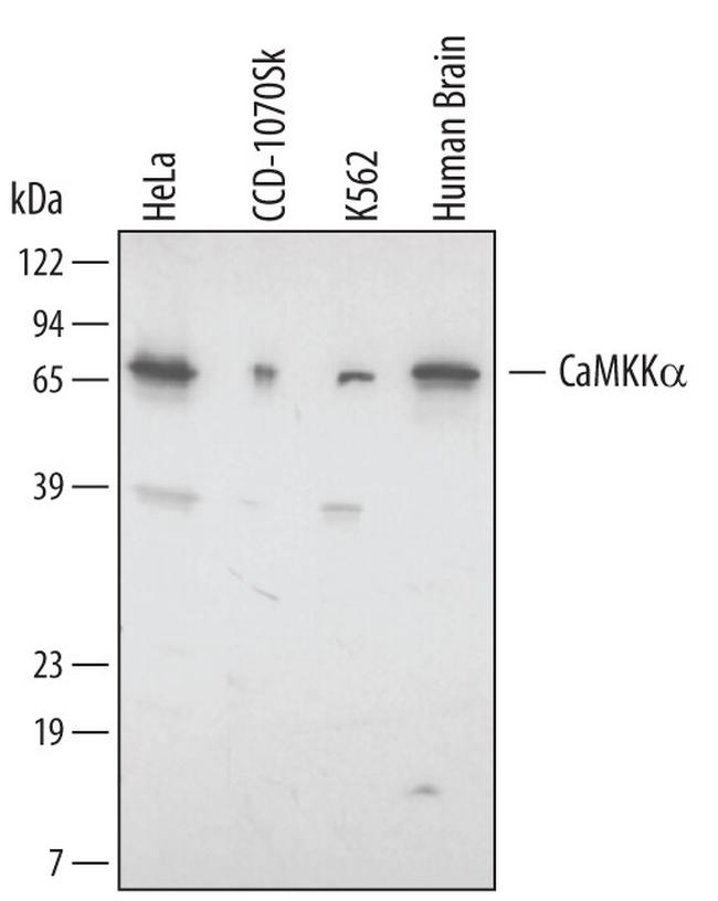 CaMKK alpha Antibody in Western Blot (WB)