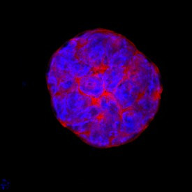 ESGP Antibody in Immunocytochemistry (ICC/IF)