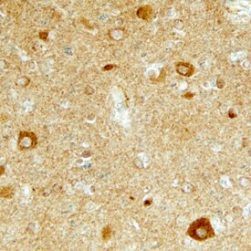 LTK Antibody in Immunohistochemistry (Paraffin) (IHC (P))