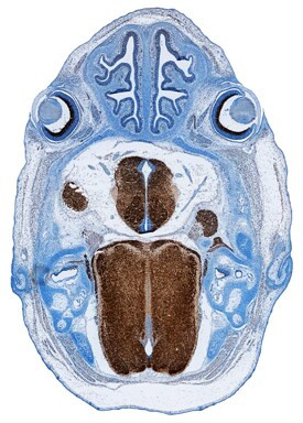 SEZ6L2 Antibody in Immunohistochemistry (Frozen) (IHC (F))