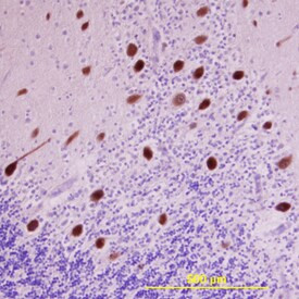 LRRC4 Antibody in Immunohistochemistry (Paraffin) (IHC (P))