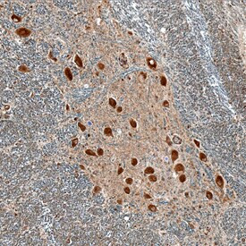 LRRC3 Antibody in Immunohistochemistry (Paraffin) (IHC (P))