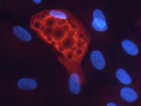 PNPLA3 Antibody in Immunocytochemistry (ICC/IF)
