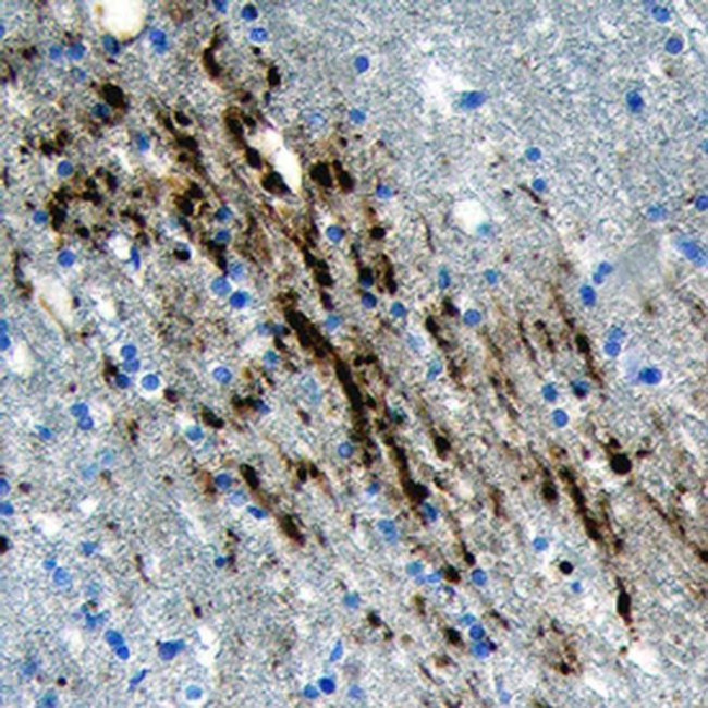 CLSTN3 Antibody in Immunohistochemistry (Paraffin) (IHC (P))