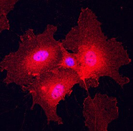 Plexin A2 Antibody in Immunocytochemistry (ICC/IF)