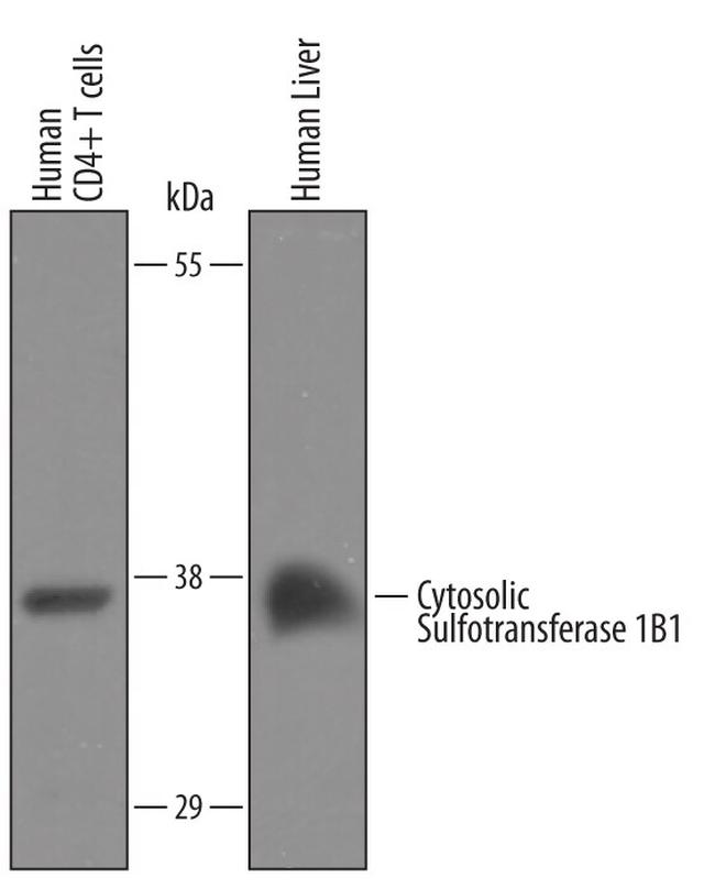 SULT1B1 Antibody in Western Blot (WB)