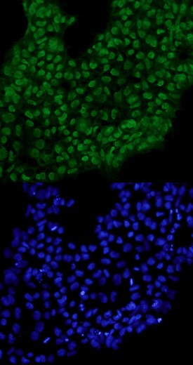 TCF7L1 Antibody in Immunocytochemistry (ICC/IF)