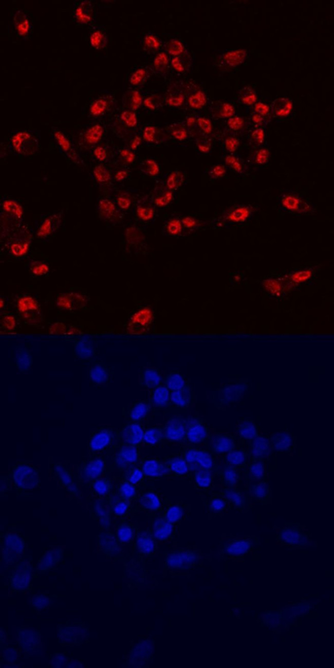PTF1A Antibody in Immunocytochemistry (ICC/IF)