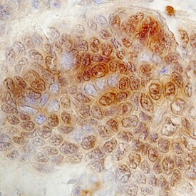 FOXK1 Antibody in Immunohistochemistry (Paraffin) (IHC (P))