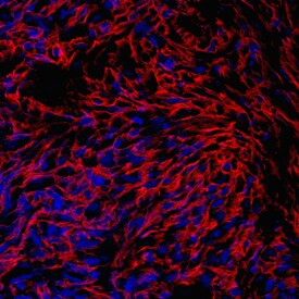 PRELP Antibody in Immunocytochemistry (ICC/IF)