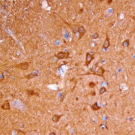 Neurocan Antibody in Immunohistochemistry (Paraffin) (IHC (P))