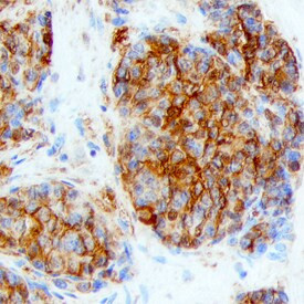 LY6K Antibody in Immunohistochemistry (Paraffin) (IHC (P))