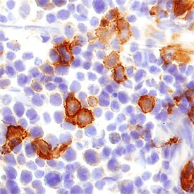 CLEC9A Antibody in Immunohistochemistry (Frozen) (IHC (F))