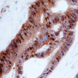 ITGB1BP1 Antibody in Immunohistochemistry (Paraffin) (IHC (P))