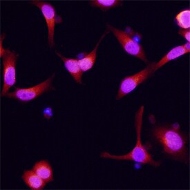 Dynactin 2 Antibody in Immunocytochemistry (ICC/IF)