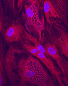 CLTCL1 Antibody in Immunocytochemistry (ICC/IF)