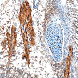 EBF2 Antibody in Immunohistochemistry (Frozen) (IHC (F))