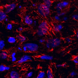 IMPAD1 Antibody in Immunocytochemistry (ICC/IF)