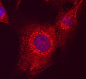 MAGI2 Antibody in Immunocytochemistry (ICC/IF)