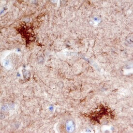 DOCK3 Antibody in Immunohistochemistry (Paraffin) (IHC (P))