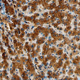 GALNT1 Antibody in Immunohistochemistry (Paraffin) (IHC (P))