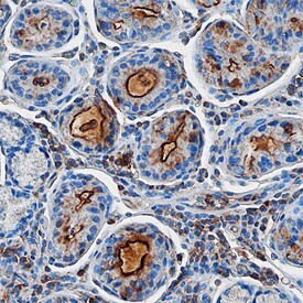 GKN1 Antibody in Immunohistochemistry (Paraffin) (IHC (P))
