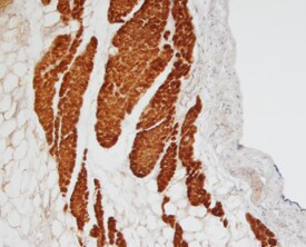 MYBPC3 Antibody in Immunohistochemistry (Paraffin) (IHC (P))