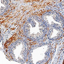 TMEM219 Antibody in Immunohistochemistry (Paraffin) (IHC (P))