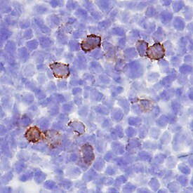 CD137 Antibody in Immunohistochemistry (Frozen) (IHC (F))