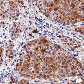 GREM1 Antibody in Immunohistochemistry (Paraffin) (IHC (P))