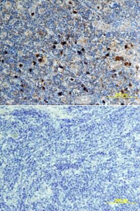 CXCL16 Antibody in Immunohistochemistry (Paraffin) (IHC (P))