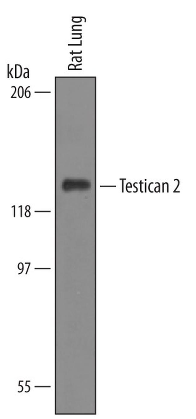 SPOCK2 Antibody in Western Blot (WB)