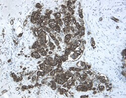 CHRDL2 Antibody in Immunohistochemistry (Paraffin) (IHC (P))