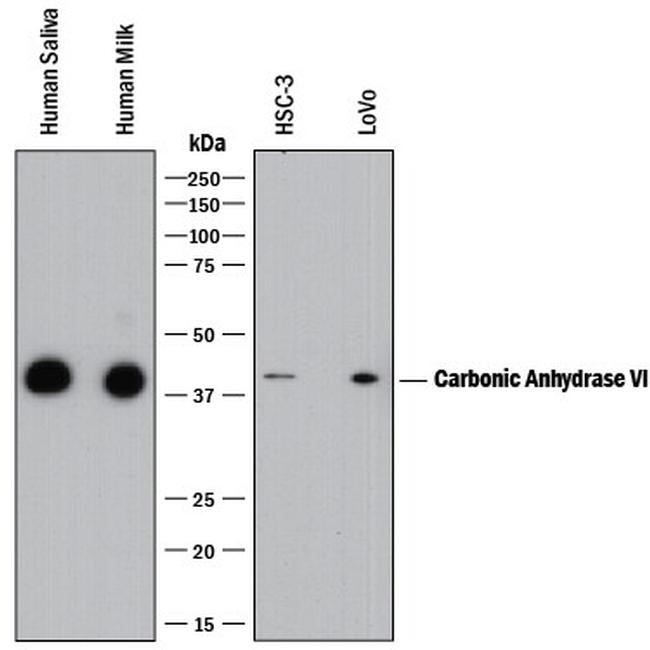 Carbonic Anhydrase VI Antibody in Western Blot (WB)