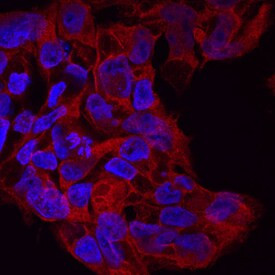 DISP1 Antibody in Immunocytochemistry (ICC/IF)
