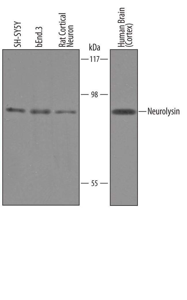 NLN Antibody in Western Blot (WB)